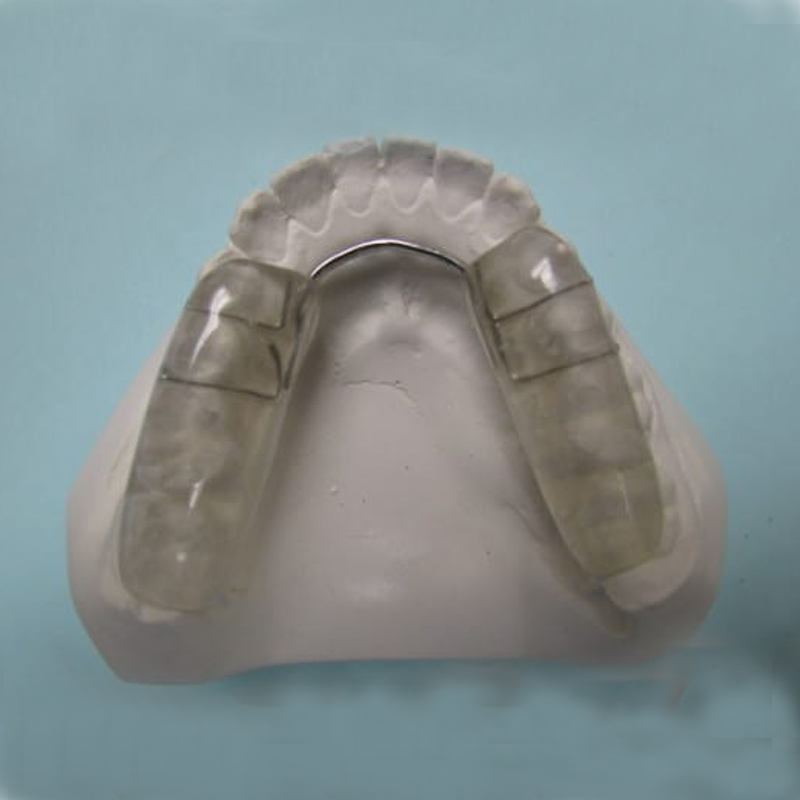 บทนำและข้อบ่งชี้ของเฝือกสบฟันที่มั่นคง