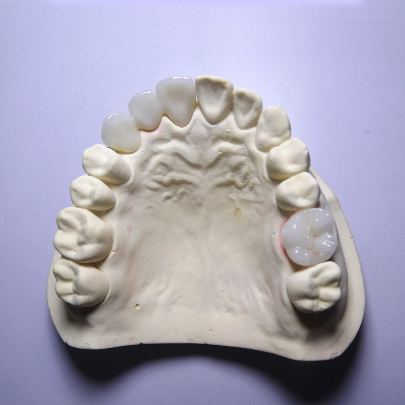 ต้องทราบข้อดีของเซอร์โคเนียเหล่านี้