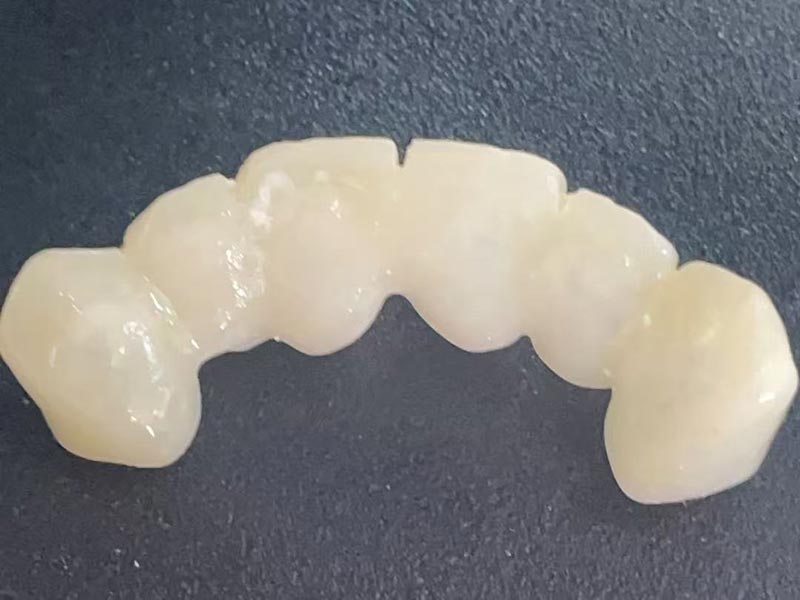 “มงกุฎชั่วคราว” คืออะไร? ทำไมคุณถึงต้องการ?