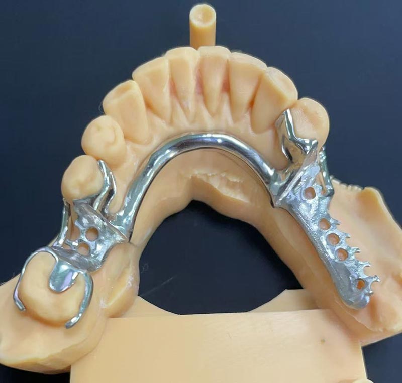 ข้อดีของกรอบโคบอลต์-โครเมียม (กรอบ Co Cr)