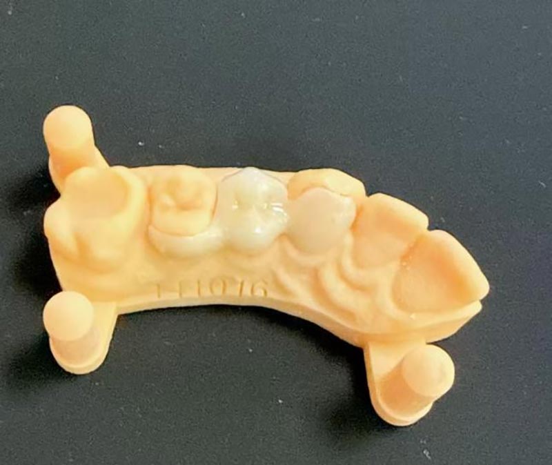 สิ่งที่คุณต้องรู้เกี่ยวกับสะพานแมริแลนด์?