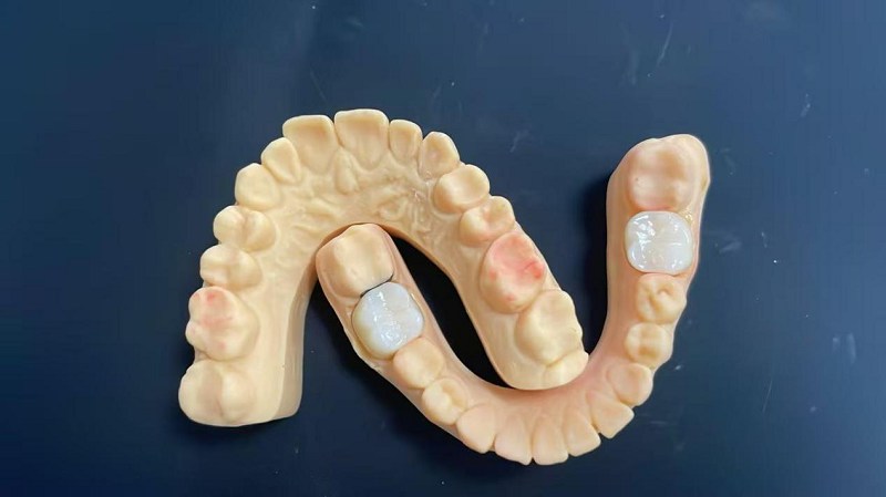 ขอบไหล่คืออะไร?