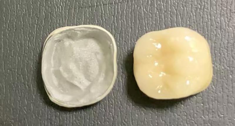 WM DENTAL LAB – แล็บทันตกรรมชั้นนำของจีน