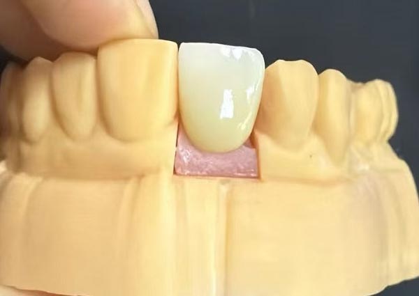 ช่องว่างระหว่างฟันสามารถแก้ไขได้—ฟันเรียงตรงน่าดึงดูดที่สุด!