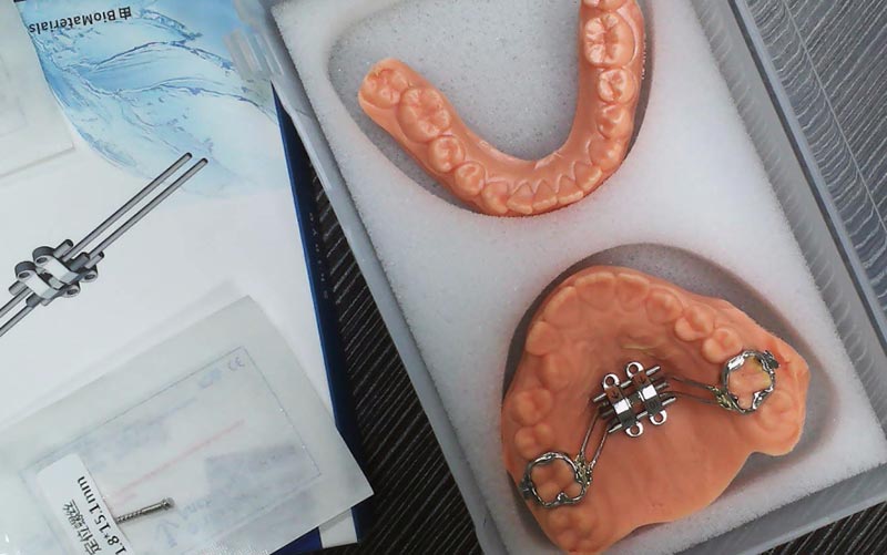 ทำความเข้าใจการขยายโครงกระดูกของ MSE ด้วย WM Dental Lab