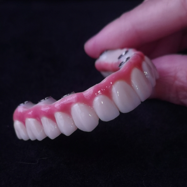 All On X Hybrid Bridge - สะพาน Zirconia เต็มรูปแบบเหนือ Tibases