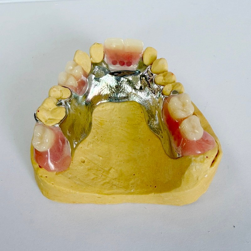 กรอบการทำงานบางส่วนการคืนค่าแบบถอดได้